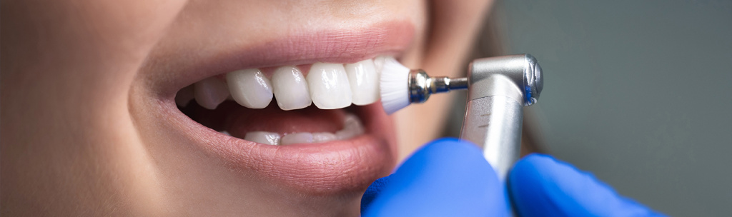 Teeth-Cleaning-1-1.jpg Teeth-Cleaning-1-1.jpg